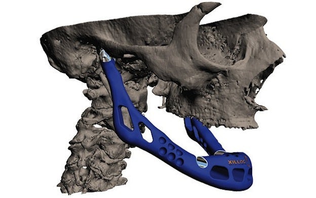 jaw